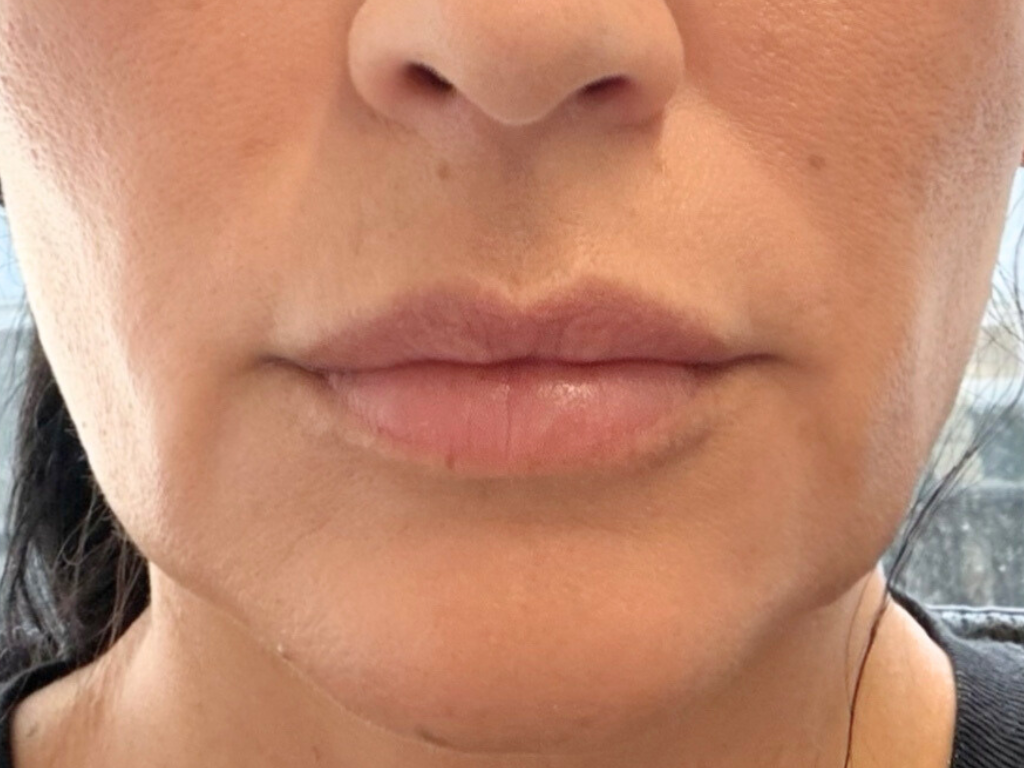 After 4 Weeks